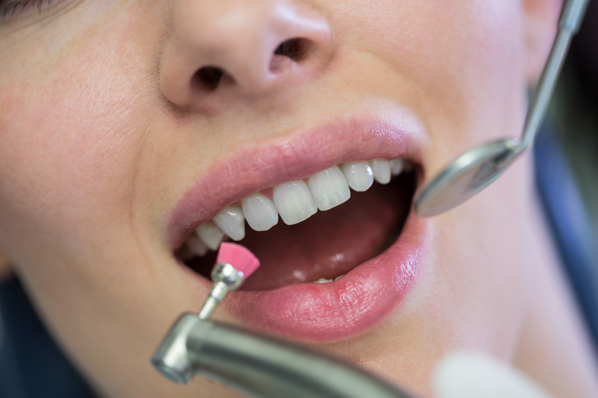 Igiene Dentale | Studio Dentistico Empoli Eumedica